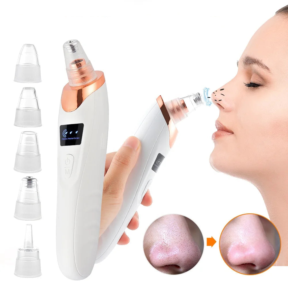 Sumei Ange Blackhead Remover