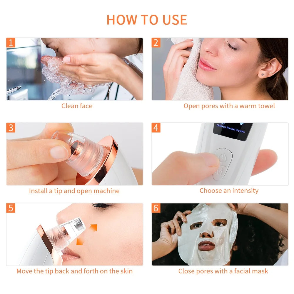 Sumei Ange Blackhead Remover